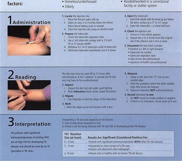 Tb Test